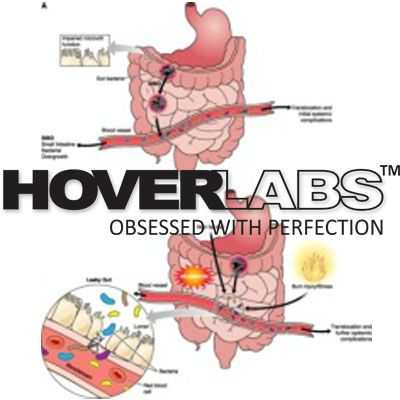 Enterobacteriacea Model