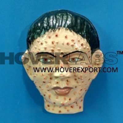 Small Pox Face Model