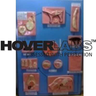 Life Cycle of Echonococcus Granulossus Model