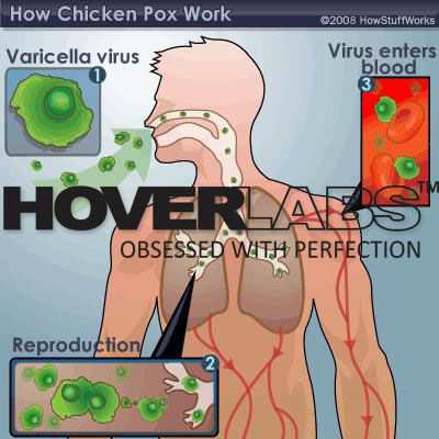 Pathology and Pathogenesis of Pox Virus Model