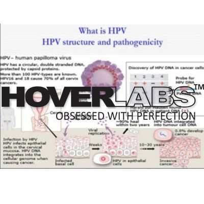 Life Cycle of Papilloma Virus Model