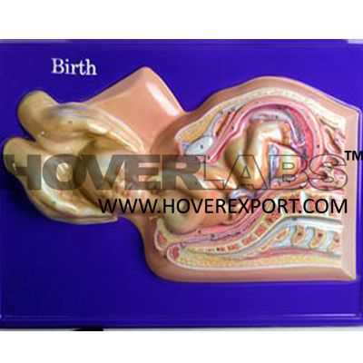 Delievery Birth Set Model