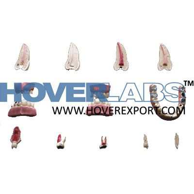 Human Teeth - Set Of 16